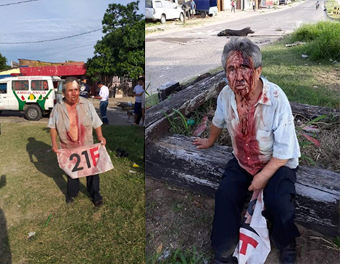 Agreden-a-un-adulto-mayor-con-piedras-porque-se-opuso-al-desbloqueo-de-la-via