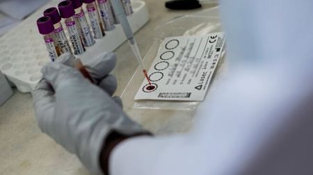 El tratamiento de la tuberculosis y los servicios de prevención del VIH cayeron en 2020 por la pandemia