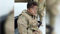 Contrabandistas impactan su vehículo contra motorizado militar, dejan heridos leves y de gravedad
