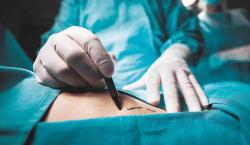Una tragedia en Santa Cruz: extranjera pierde la vida tras una cirugía estética