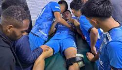 Malas noticias en Blooming: Samuel Garzón sufre graves lesiones y se despide de la temporada