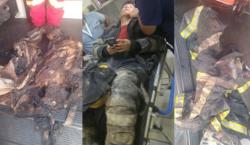 Denuncian que bomberos heridos en explosión no contaban con equipos adecuados