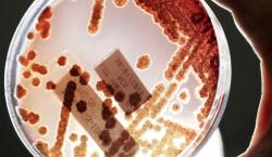 Aumentan en Estados Unidos las infecciones por bacterias resistentes a los antibióticos